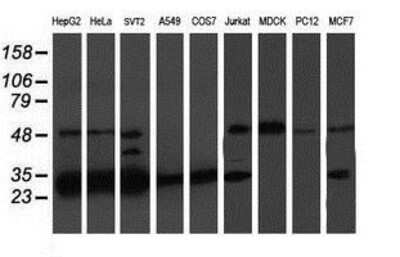 Western Blot: PSMB7 Antibody (OTI1E1) [NBP2-01832] - Analysis of extracts (35ug) from 9 different cell lines by using anti-Proteasome 20S beta 7 monoclonal antibody.