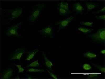 Immunocytochemistry/Immunofluorescence: Proteasome 20S beta 7 Antibody [H00005695-B03P] - Analysis of purified antibody to PSMB7 on HeLa cell. Antibody concentration 10 ug/ml