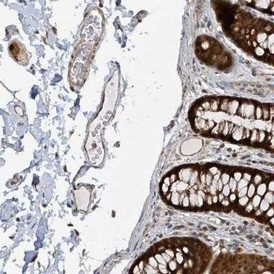 Immunohistochemistry-Paraffin: PSMB7 Antibody [NBP2-13821] - Staining of human colon shows strong cytoplasmic and nuclear positivity in glandular cells and peripheral nerve/ganglion.