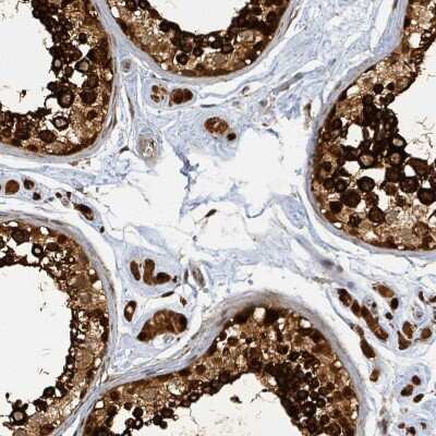 Immunohistochemistry-Paraffin: PSMB7 Antibody [NBP2-13821] - Staining of human testis shows high expression.