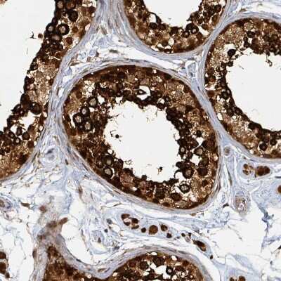 Immunohistochemistry-Paraffin: PSMB7 Antibody [NBP2-13821] - Staining of human testis shows positivity in cells in seminiferous ducts.