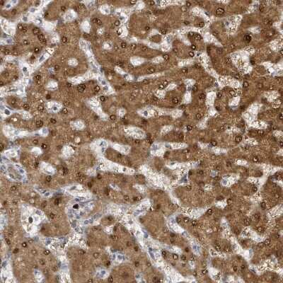 Immunohistochemistry-Paraffin: PSMB7 Antibody [NBP2-13821] - Staining of human liver shows positivity in hepatocytes.