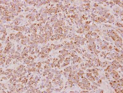 Immunohistochemistry-Paraffin: PSMB7 Antibody [NBP2-19954] - MDA-MB157 xenograft, using Proteasome 20S beta 7 antibody at 1:100 dilution. Antigen Retrieval: Trilogy™ (EDTA based, pH 8.0) buffer, 15min. 