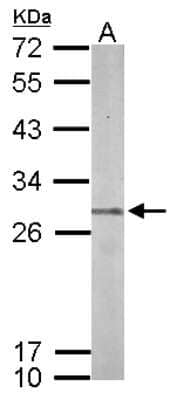 Western Blot: PSMB7 Antibody [NBP2-19954] -  Sample (50 ug of whole cell lysate) A: Mouse Brain, 12% SDS PAGE gel, diluted at 1:1000.