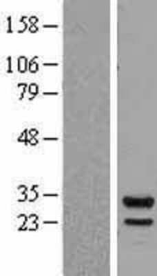 Western Blot: Proteasome 20S beta 7 Overexpression Lysate (Adult Normal) [NBL1-14882] Left-Empty vector transfected control cell lysate (HEK293 cell lysate); Right -Over-expression Lysate for Proteasome 20S beta 7.