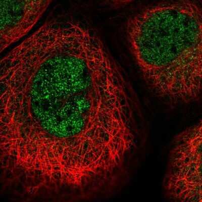 Immunocytochemistry/Immunofluorescence: Proteasome 20S beta2 Antibody [NBP1-92294] - Staining of human cell line A-431 shows localization to nucleoplasm. Antibody staining is shown in green.