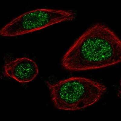 Immunocytochemistry/Immunofluorescence: Proteasome 20S beta2 Antibody [NBP1-92295] - Immunofluorescent staining of human cell line PC-3 shows localization to nucleoplasm.