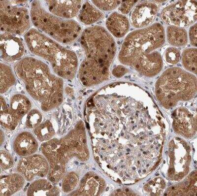 Immunohistochemistry-Paraffin Proteasome 20S beta2 Antibody