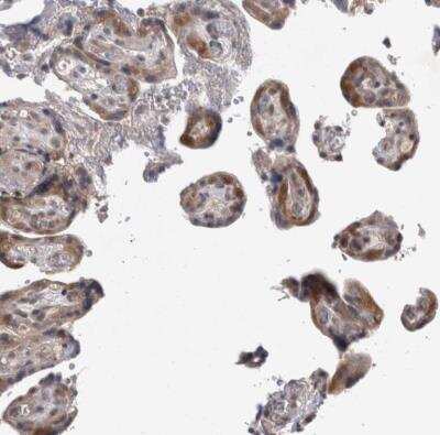 Immunohistochemistry-Paraffin Proteasome 20S beta2 Antibody