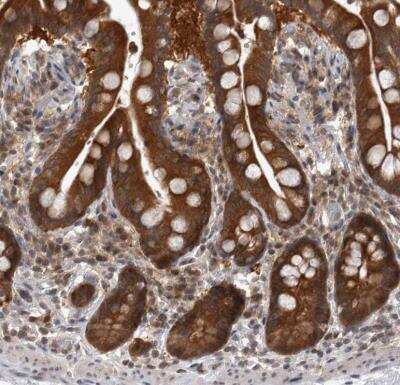 Immunohistochemistry-Paraffin Proteasome 20S beta2 Antibody