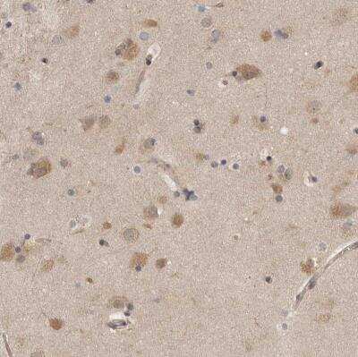 Immunohistochemistry-Paraffin: Proteasome 20S beta2 Antibody [NBP1-92294] - Staining of human cerebral cortex shows weak to moderate cytoplasmic positivity in neurons.