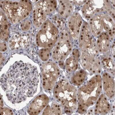 Immunohistochemistry-Paraffin: Proteasome 20S beta2 Antibody [NBP1-92295] - Staining of human kidney shows cytoplasmic and nuclear positivity in cells in tubules.