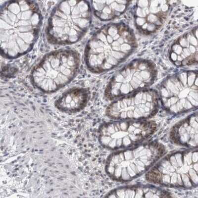 Immunohistochemistry-Paraffin: Proteasome 20S beta2 Antibody [NBP1-92295] - Staining of human colon shows moderate nuclear positivity in glandular cells.