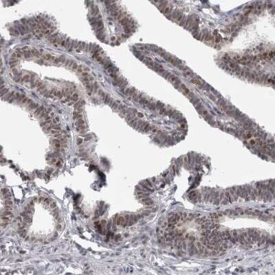 Immunohistochemistry-Paraffin: Proteasome 20S beta2 Antibody [NBP1-92295] - Staining of human fallopian tube shows moderate nuclear positivity in glandular cells.