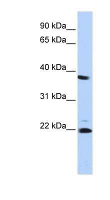 Western Blot: Proteasome 20S beta2 Antibody [NBP1-54589] - HepG2 cell lysate, concentration 0.2-1 ug/ml.