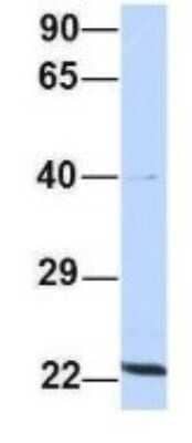 Western Blot: Proteasome 20S beta2 Antibody [NBP1-54589] - Analysis of 293T cell lysate. Antibody Dilution: 1.0 ug/ml PSMB2 is supported by BioGPS gene expression data to be expressed in HEK293T.