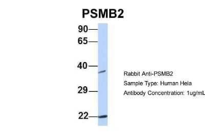 Western Blot: Proteasome 20S beta2 Antibody [NBP1-54589] - Hela, Antibody Dilution: 1.0 ug/ml PSMB2 is strongly supported by BioGPS gene expression data to be expressed in Human HeLa cells.