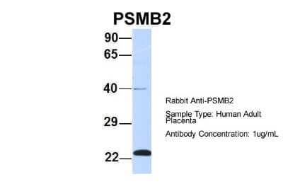 Western Blot: Proteasome 20S beta2 Antibody [NBP1-54589] - Human Adult Placenta, Antibody Dilution: 1.0 ug/ml.