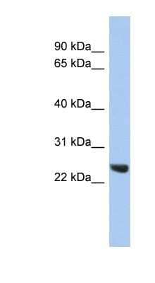 Western Blot: Proteasome 20S beta2 Antibody [NBP1-54590] - Titration: 0.2-1 ug/ml, Positive Control: Hela cell lysate.