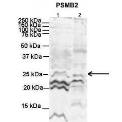 Western Blot: Proteasome 20S beta2 Antibody [NBP1-54590] - Titration: 2 ug/ml Positive Control: Human NT-2 cells and Mouse WT brain.