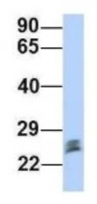 Western Blot: Proteasome 20S beta2 Antibody [NBP1-54590] - Jurkat, Antibody Dilution: 1.0 ug/ml PSMB2 is strongly supported by BioGPS gene expression data to be expressed in Jurkat.