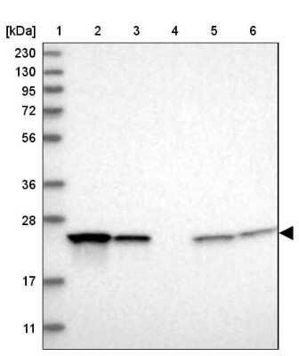 Western Blot: Proteasome 20S beta2 Antibody [NBP1-92294] - Lane 1: Marker  [kDa] 230, 130, 95, 72, 56, 36, 28, 17, 11.  Lane 2: Human cell line RT-4.  Lane 3: Human cell line U-251MG sp.  Lane 4: Human plasma (IgG/HSA depleted).  Lane 5: Human liver tissue.  Lane 6: Human tonsil tissue