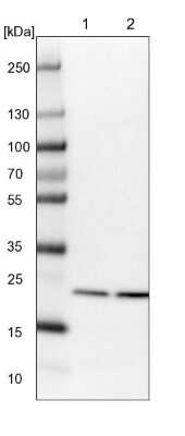 Western Blot: Proteasome 20S beta2 Antibody [NBP1-92294] - Lane 1: NIH-3T3 cell lysate (Mouse embryonic fibroblast cells). Lane 2: NBT-II cell lysate (Rat Wistar bladder tumor cells).