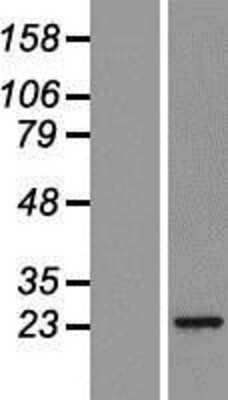 Western Blot: Proteasome 20S beta2 Overexpression Lysate (Adult Normal) [NBL1-14877] Left-Empty vector transfected control cell lysate (HEK293 cell lysate); Right -Over-expression Lysate for Proteasome 20S beta2.