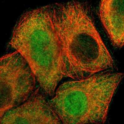 Immunocytochemistry/ Immunofluorescence Proteasome 26S S5 Antibody - BSA Free