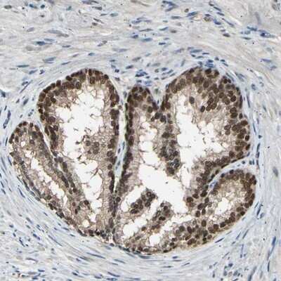 Immunohistochemistry-Paraffin Proteasome 26S S5 Antibody - BSA Free