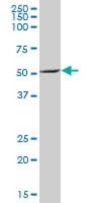 Western Blot: Proteasome 26S S5 Antibody [H00005711-B01P] - Analysis of PSMD5 expression in human spleen.