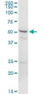 Western Blot: Proteasome 26S S5 Antibody [H00005711-D01P] - Analysis of PSMD5 expression in HeLa.