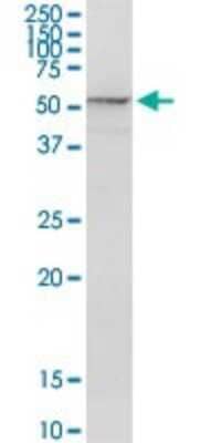 Western Blot: Proteasome 26S S5 Antibody [H00005711-D01P] - Analysis of PSMD5 expression in human stomach.