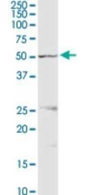 Western Blot: Proteasome 26S S5 Antibody [H00005711-D01P] - Analysis of PSMD5 expression in mouse spleen.