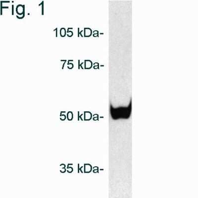 Western Blot: Proteasome 26S S5 Antibody [NB120-3319] - Analysis of proteasome 19S subunit S5b on purified 26S proteasome.