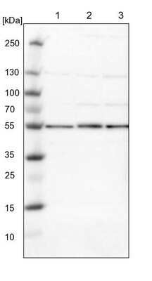Western Blot Proteasome 26S S5 Antibody - BSA Free