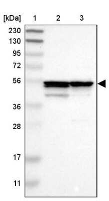 Western Blot Proteasome 26S S5 Antibody - BSA Free