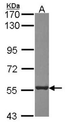 Western Blot: Proteasome 26S S5 Antibody [NBP2-19956] - Sample (30 ug of whole cell lysate) A: A431 7. 5% SDS PAGE gel, diluted at 1:1000.