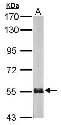 Western Blot Proteasome 26S S5 Antibody - BSA Free