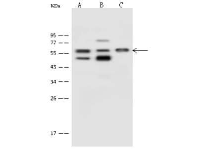 Western Blot: Proteasome 26S S5 Antibody [NBP2-99617] - Anti-Proteasome 26S S5 rabbit polyclonal antibody at 1:500 dilution. Lane A: A431 Whole Cell Lysate Lane B: Hela Whole Cell Lysate Lane C: HepG2 Whole Cell Lysate Lysates/proteins at 30 ug per lane. Secondary Goat Anti-Rabbit IgG (H+L)/HRP at 1/10000 dilution. Developed using the ECL technique. Performed under reducing conditions. Predicted band size: 56 kDa. Observed band size: 57 kDa