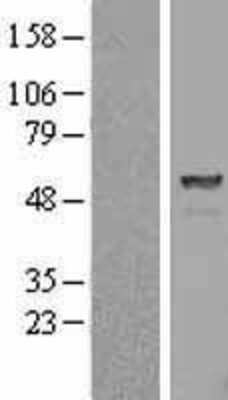 Western Blot Proteasome 26S S5 Overexpression Lysate