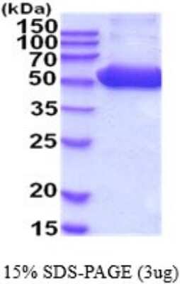 SDS-Page: Proteasome 26S S5 Recombinant Protein [NBP2-52158] - 15% SDS Page (3 ug)