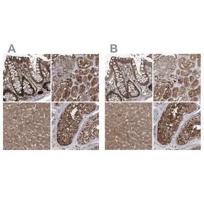 Immunohistochemistry-Paraffin: Proteasome beta 1 Antibody [NBP1-89713] - Staining of human colon, kidney, liver and testis using Anti-PSMB1 antibody NBP1-89713 (A) shows similar protein distribution across tissues to independent antibody NBP1-89714 (B).