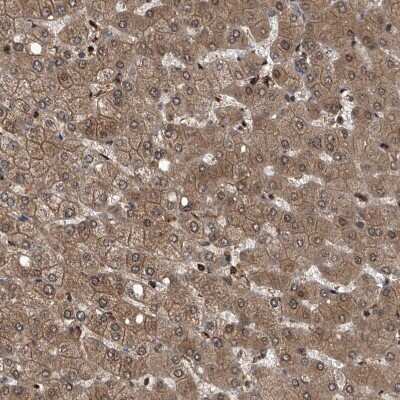 Immunohistochemistry-Paraffin: Proteasome beta 1 Antibody [NBP1-89713] - Staining of human liver shows moderate to strong cytoplasmic positivity in hepatocytes.