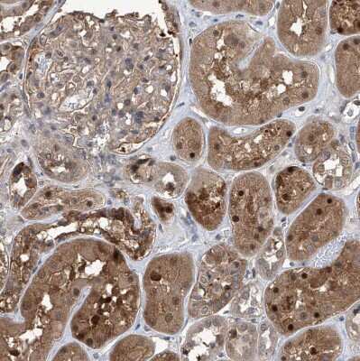 Immunohistochemistry-Paraffin: Proteasome beta 1 Antibody [NBP1-89714] - Staining of human kidney shows moderate to strong cytoplasmic and nuclear positivity in cells in tubules.