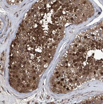 Immunohistochemistry-Paraffin: Proteasome beta 1 Antibody [NBP1-89714] - Staining of human testis shows moderate to strong cytoplasmic and nuclear positivity in cells in seminiferous ducts.