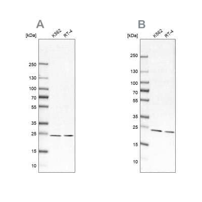 Western Blot: Proteasome beta 1 Antibody [NBP1-89714] - Analysis using Anti-PSMB1 antibody NBP1-89714 (A) shows similar pattern to independent antibody NBP1-89713 (B).