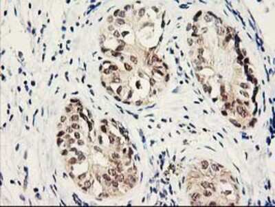 Immunohistochemistry-Paraffin Proteasome subunit beta type 4 Antibody (OTI2C9)