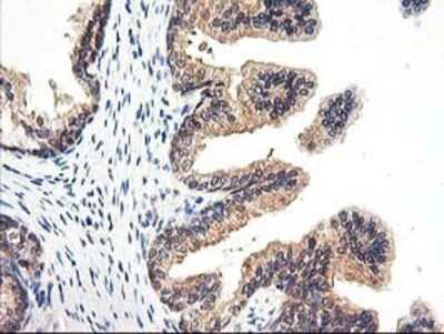 Immunohistochemistry-Paraffin: Proteasome subunit beta type 4 Antibody (2C9) [NBP2-01225] Staining of paraffin-embedded Human prostate tissue using anti-Proteasome subunit beta type 4 mouse monoclonal antibody.