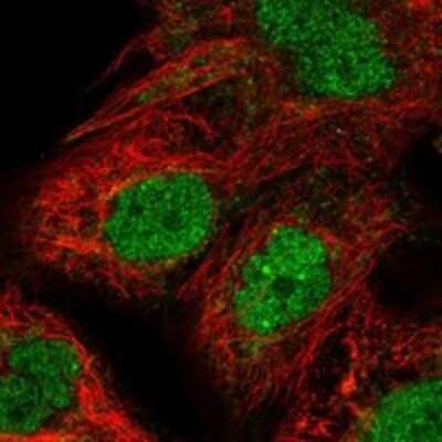 Immunocytochemistry/Immunofluorescence: Proteasome subunit beta type 4 Antibody [NBP3-17756] - Staining of human cell line EFO-21 shows localization to nucleoplasm.